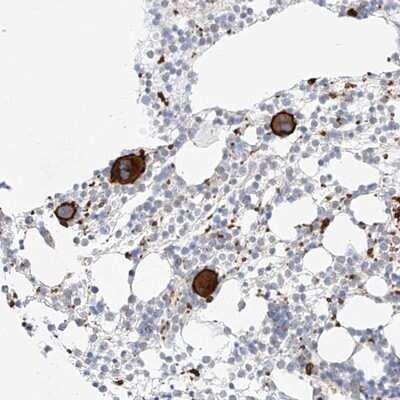 Immunohistochemistry-Paraffin: AJM1 Antibody [NBP1-90935]