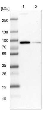 Western Blot: AJM1 Antibody [NBP1-90935]