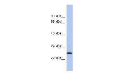 Western Blot: C9orf173 Antibody [NBP3-10635]