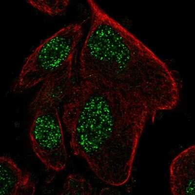 Immunocytochemistry/ Immunofluorescence: RPP25L Antibody [NBP2-56025]