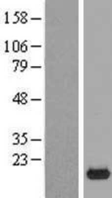 Western Blot: RPP25L Overexpression Lysate [NBL1-08590]