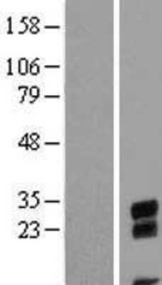 Western Blot: CBE1 Overexpression Lysate [NBL1-08591]