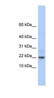 Western Blot: FAM219A Antibody [NBP1-70482]