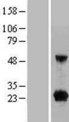 Western Blot: FAM219A Overexpression Lysate [NBP2-05440]