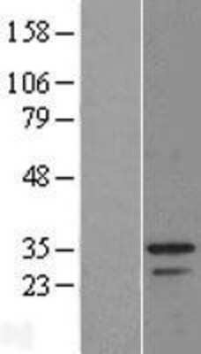 Western Blot: MSANTD3 Overexpression Lysate [NBL1-08593]