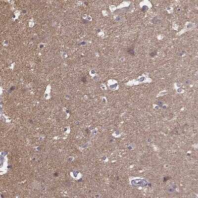 Immunohistochemistry-Paraffin: Ferric Chelate Reductase 1 Like Antibody [NBP2-58836]