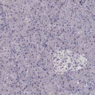 Immunohistochemistry-Paraffin: Ferric Chelate Reductase 1 Like Antibody [NBP2-58836]