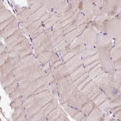 Immunohistochemistry-Paraffin: C9orf40 Antibody [NBP1-90447]