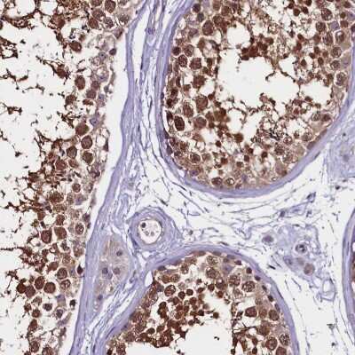 Immunohistochemistry-Paraffin: C9orf40 Antibody [NBP1-90447]