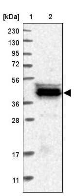 Western Blot: CARNMT1 Antibody [NBP1-82048]