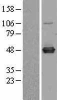 Western Blot: CARNMT1 Overexpression Lysate [NBL1-08595]