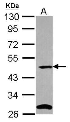 Western Blot: C9orf43 Antibody [NBP2-15654]