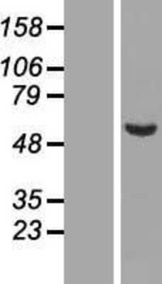 Western Blot: C9orf43 Overexpression Lysate [NBL1-08596]