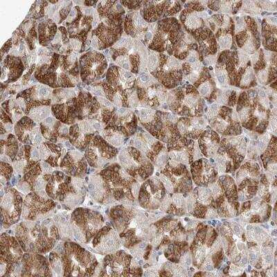 Immunohistochemistry-Paraffin: TMEM245 Antibody [NBP1-90633]