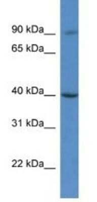 Western Blot: C9orf64 Antibody [NBP1-91505]