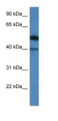 Western Blot: C9orf64 Antibody [NBP1-91506]