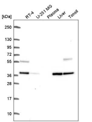 Western Blot: C9orf64 Antibody [NBP2-55699]