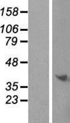 Western Blot: C9orf64 Overexpression Lysate [NBP2-06048]