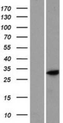 Western Blot: C9orf66 Overexpression Lysate [NBP2-05337]