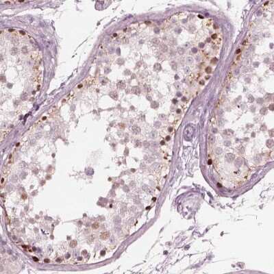 Immunohistochemistry-Paraffin: SPATA6L Antibody [NBP1-84648]