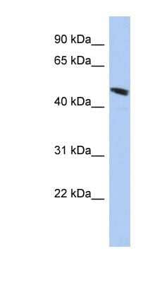 Western Blot: SPATA6L Antibody [NBP1-56828]