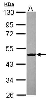 Western Blot: SPATA6L Antibody [NBP2-15655]