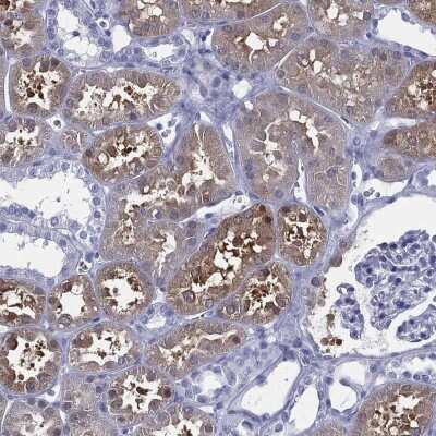 Immunohistochemistry-Paraffin: C9orf71 Antibody [NBP3-16962]