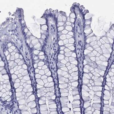 Immunohistochemistry-Paraffin: C9orf71 Antibody [NBP3-16962]
