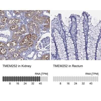 Immunohistochemistry-Paraffin: C9orf71 Antibody [NBP3-16962]