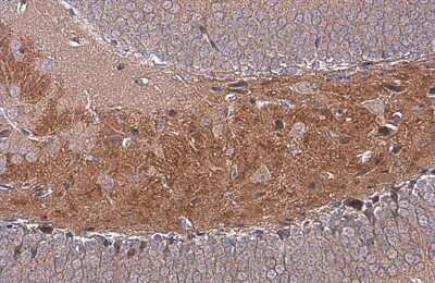 Immunohistochemistry-Paraffin: C9orf72 Antibody (GT1553) [NBP3-13622]