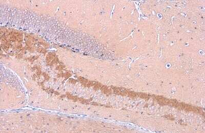 Immunohistochemistry-Paraffin: C9orf72 Antibody (GT1553) [NBP3-13622]