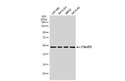 Western Blot: C9orf72 Antibody (GT1553-RB) [NBP3-13658]