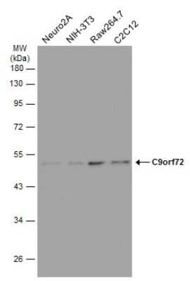 Western Blot: C9orf72 Antibody (GT1553) [NBP3-13622]
