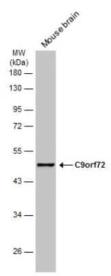 Western Blot: C9orf72 Antibody (GT1553) [NBP3-13622]