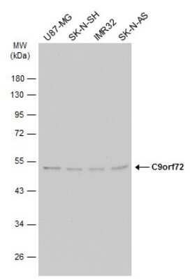 Western Blot: C9orf72 Antibody (GT1553) [NBP3-13622]