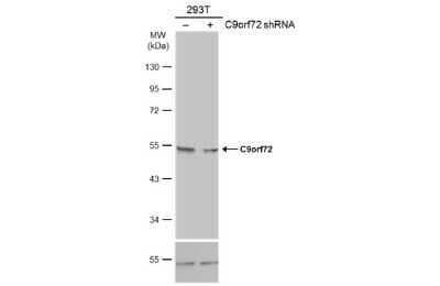 Western Blot: C9orf72 Antibody (GT1553) [NBP3-13622]