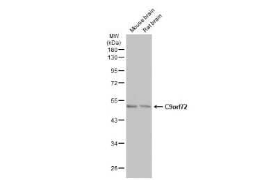 Western Blot: C9orf72 Antibody (GT779-RB) [NBP3-13657]