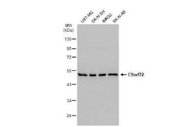 Western Blot: C9orf72 Antibody (GT779-RB) [NBP3-13657]
