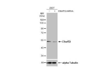 Western Blot: C9orf72 Antibody (GT779-RB) [NBP3-13657]