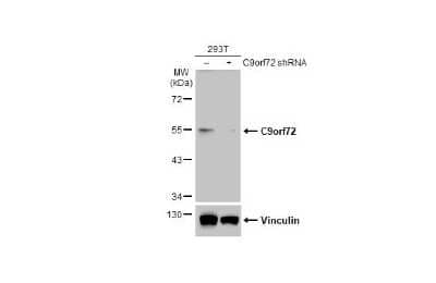 Western Blot: C9orf72 Antibody (779) [NBP3-13507]