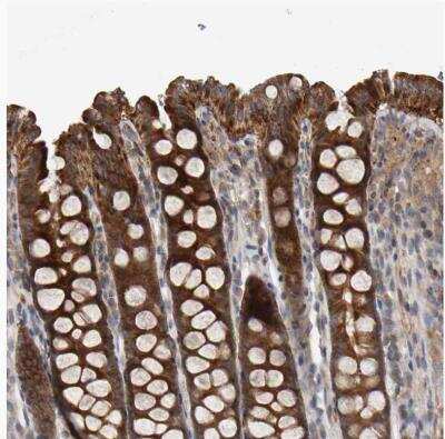 Immunohistochemistry-Paraffin: C9orf72 Antibody [NBP1-93504]