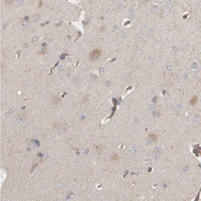 Immunohistochemistry-Paraffin: C9orf72 Antibody [NBP1-93504]