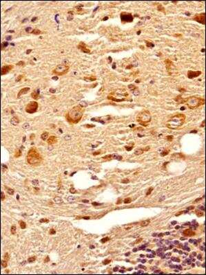 Immunohistochemistry-Paraffin: C9orf72 Antibody - BSA Free [NBP2-47146]