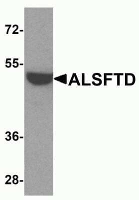 Western Blot: C9orf72 AntibodyBSA Free [NBP2-82070]