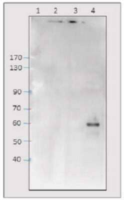 Western Blot: C9orf72 Antibody [NBP3-12198]