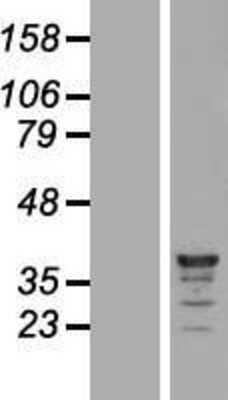 Western Blot: HCA59 Overexpression Lysate [NBL1-08601]