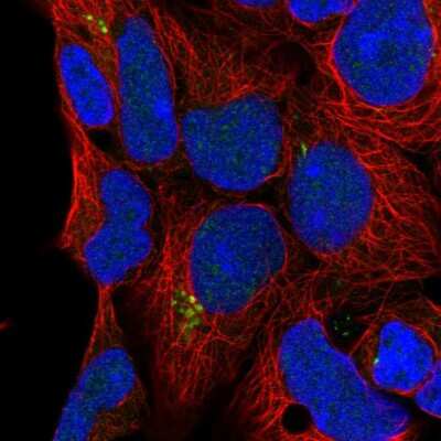 Immunocytochemistry/ Immunofluorescence: C9orf85 Antibody [NBP2-58468]