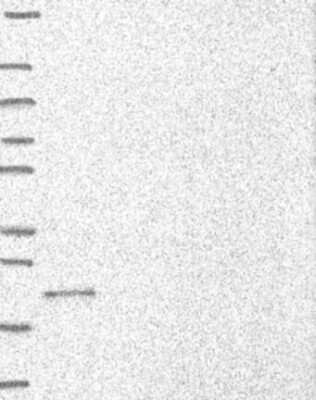 Western Blot: C9orf85 Antibody [NBP3-17573]