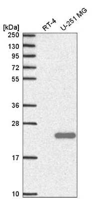 Western Blot: C9orf9 Antibody [NBP2-58670]