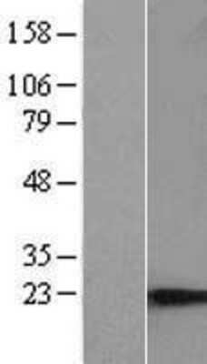 Western Blot: C9orf9 Overexpression Lysate [NBP2-06754]